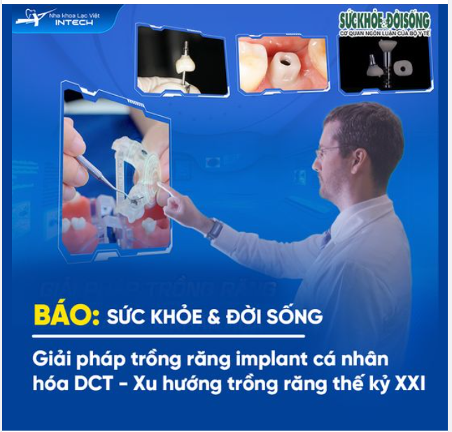 GIẢI PHÁP TRỒNG RĂNG IMPLANT DCT - XU HƯỚNG TRỒNG RĂNG THẾ KỶ XXI