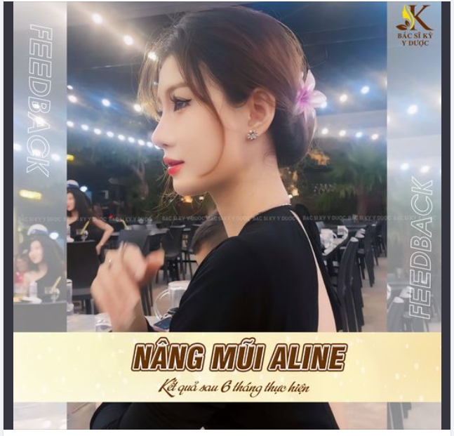 NÂNG MŨI ALINE - "LỘT XÁC" NGOẠN MỤC