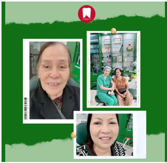 PHỤC HÌNH RĂNG ĂN NHAI CHO NGƯỜI CAO TUỔI VỚI SỨ THẨM MỸ