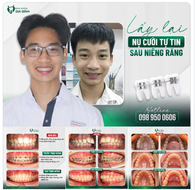 SAU 3 NĂM KIÊN TRÌ, NHẬN KẾT QUẢ MỸ MÃN