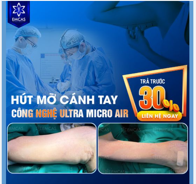 HÚT MỠ CHUẨN Y HỌC, GIÁ CẢ HỢP LÝ