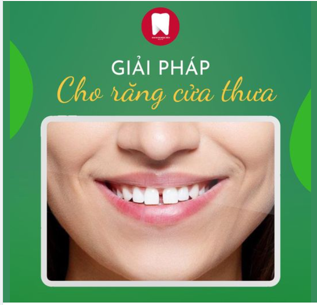 GIẢI PHÁP NÀO CHO TÌNH TRẠNG RĂNG CỬA THƯA