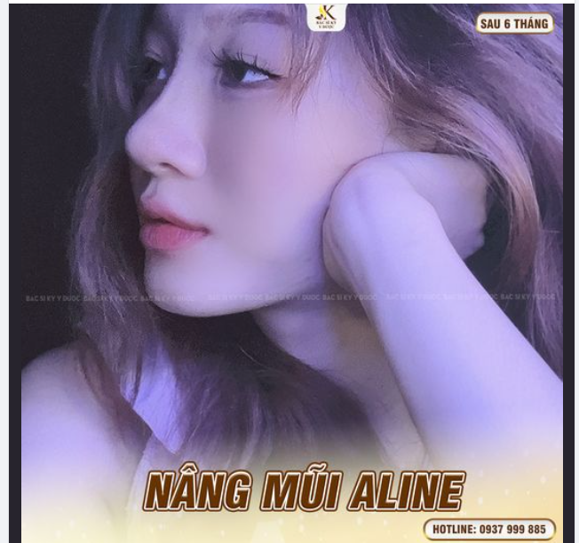 NÂNG MŨI ALINE - 60 PHÚT “XÓA SỔ” KHUYẾT ĐIỂM