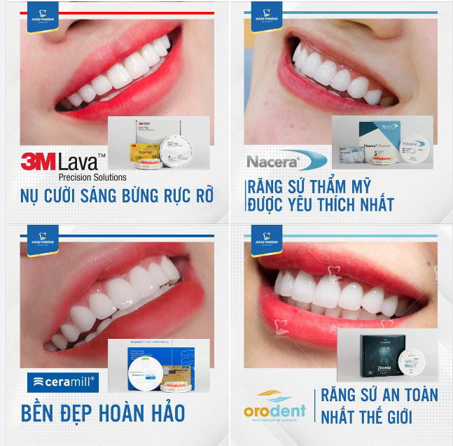 Điểm danh các loại sứ được lựa chọn nhiều nhất tại Nha khoa Ngân Phượng