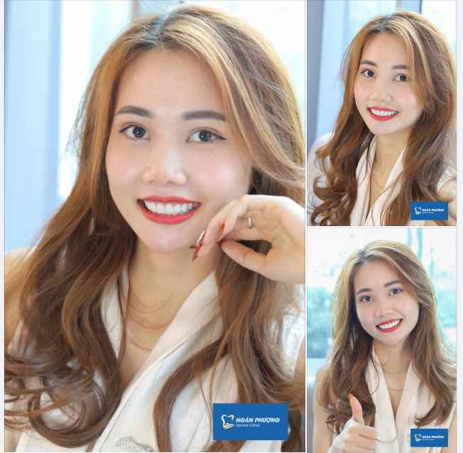 Ngày chủ nhật gặp lại cô gái Thanh Tâm tái khám sau 2 năm