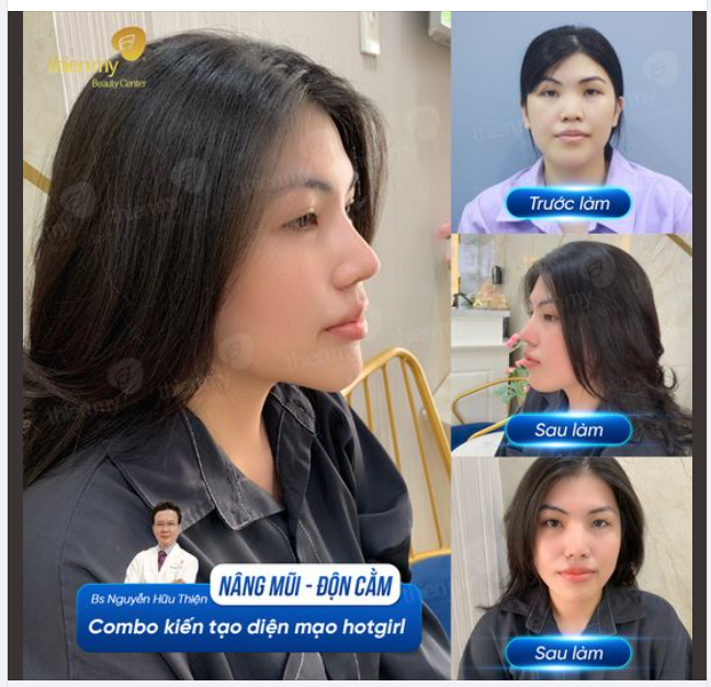 Cảm thấy xưng đáng khi đầu tư thay đổi!