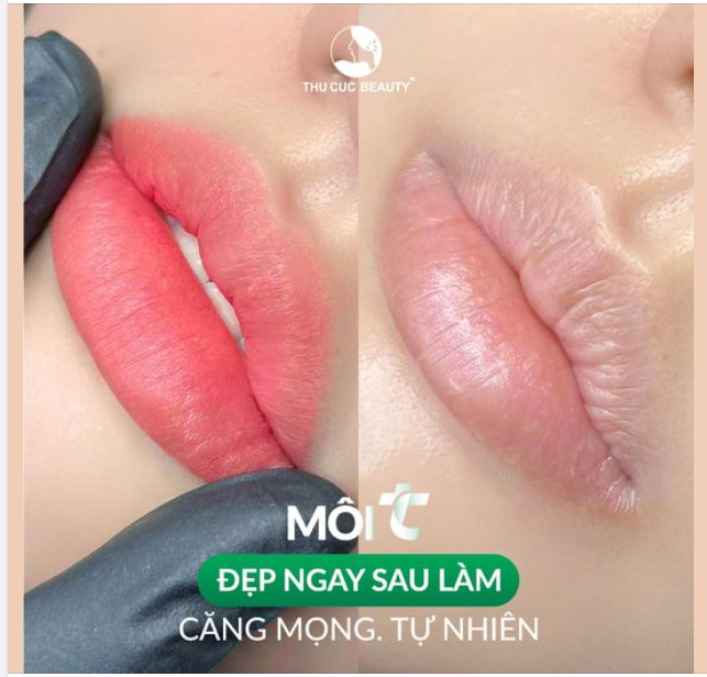 Duy nhất 6 suất giá gốc Môi TC - Đẹp ngay sau làm