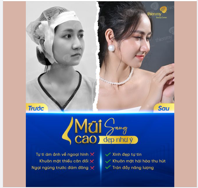 Sự Thay Đổi 180 Độ Của Nhân Viên Tư Vấn Tại Thiện Mỹ Sau Nâng Mũi