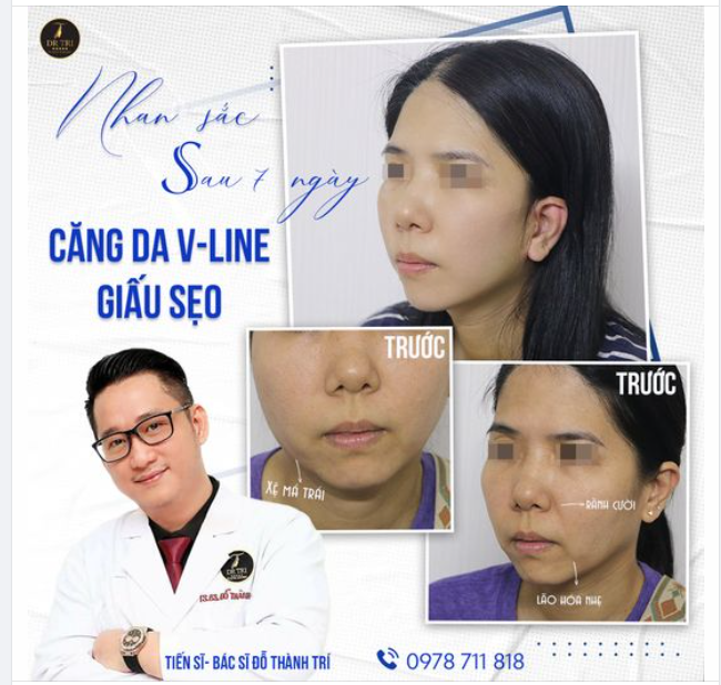XÓA BỎ ĐỊNH KIẾN CHỈ CẦN CĂNG DA MẶT Ở TUỔI XẾ CHIỀU!!