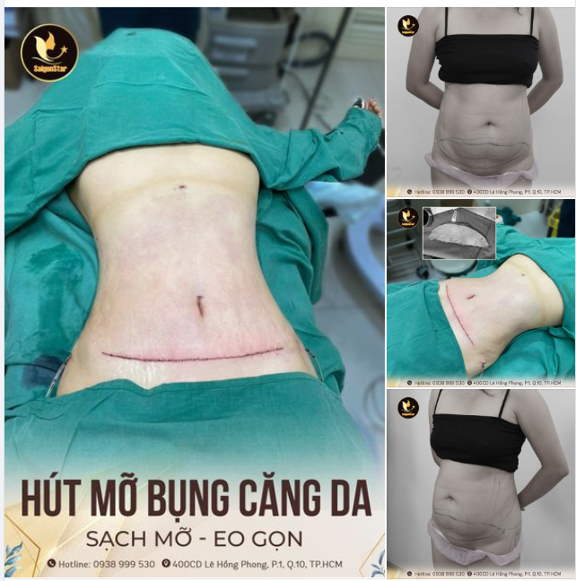90 PHÚT ĐỐT SẠCH MỠ THỪA - TẠO HÌNH EO THON GỌN
