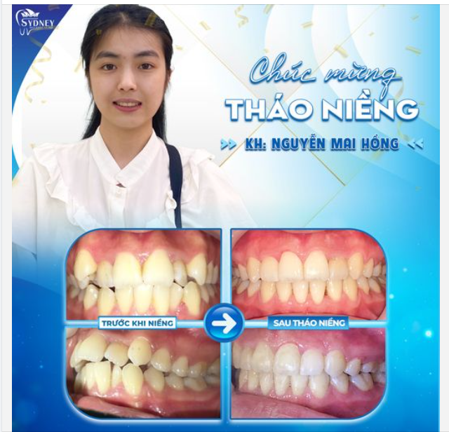 CHÚC MỪNG KH. MAI HỒNG THÁO NIỀNG THÀNH CÔNG