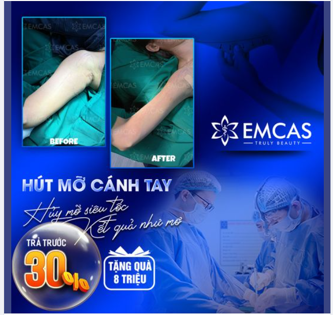 Tại EMCAS, xóa bắp tay to “nhàn tênh” với công nghệ cao, có thể tái sử dụng mỡ thừa làm đẹp các bộ phận khác