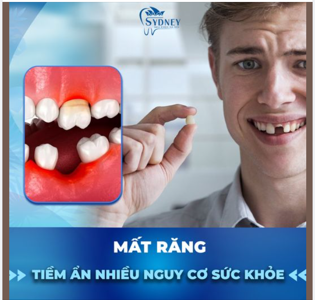 MẤT RĂNG - TIỀM ẨN NHIỀU NGUY CƠ SỨC KHỎE