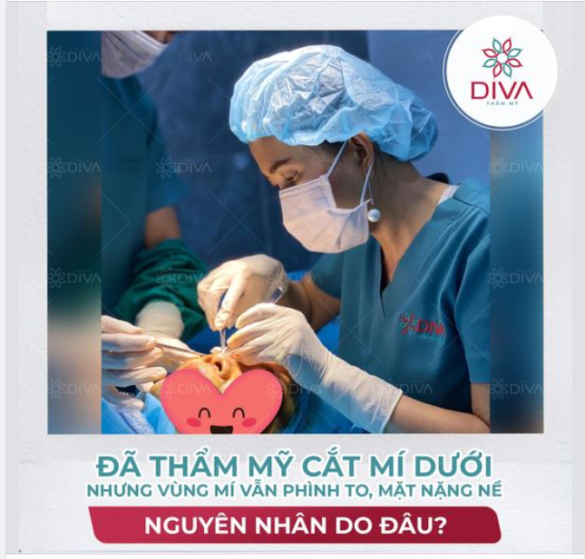 ĐÃ TRẢI QUA THẨM MỸ CẮT MÍ MẮT DƯỚI NHƯNG VÙNG MÍ DƯỚI VẪN PHÌNH TO, MẶT NẶNG NỀ - NGUYÊN NHÂN LÀ GÌ?