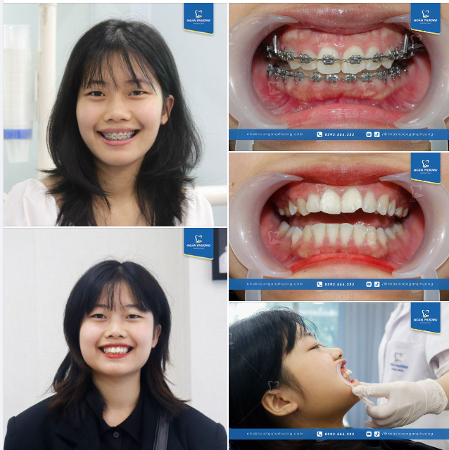 Chúc mừng Cẩm Tú đã tìm được nụ cười xinh đẹp nhất