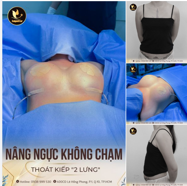 VÒNG 1 CĂNG ĐÉT - THOÁT KIẾP 2 LƯNG CHỈ SAU 60 PHÚT