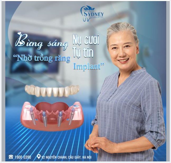 BỪNG SÁNG NỤ CƯỜI NHỜ TRỒNG RĂNG IMPLANT