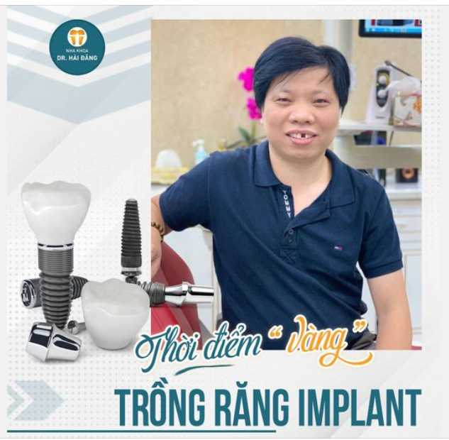 THỜI ĐIỂM " VÀNG " TRỒNG RĂNG IMPLANT