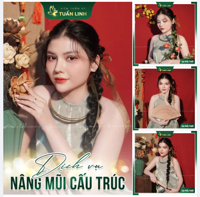 NÂNG MŨI CẤU TRÚC -”KIẾN TẠO” GÓC NGHIÊNG THẦN THÁI