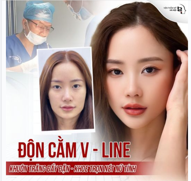ĐỘN CẰM VLINE KHUÔN TRĂNG ĐẦY ĐẶN - KHOE TRỌN NÉT ĐẸP NỮ TÍNH