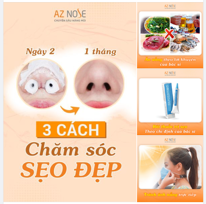Đừng bỏ qua ​​​​​​​3 tips cực đơn giản này để sở hữu SEO ĐẸP sau nâng mũi!