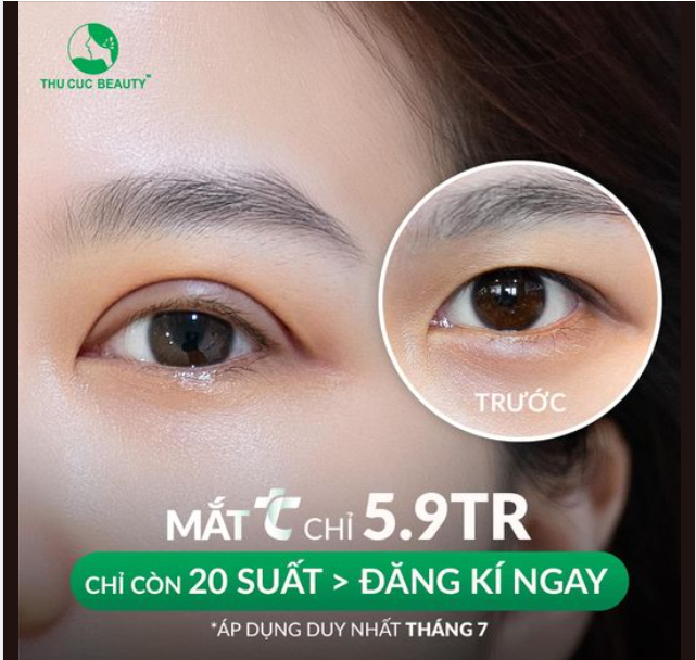 Bạn được gì sau khi bỏ ra 5,9Tr cắt mí tại Thu Cúc