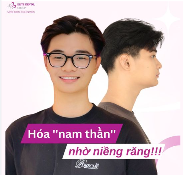 SỞ HỮU NỤ CƯỜI TỎA NẮNG CHUẨN ‘’NAM THẦN’’ NHỜ VÀO NIỀNG RĂNG!!