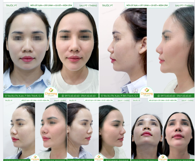 1 pha thay đổi ngoạn mục đến từ vị trí của nàng khách Charming đây