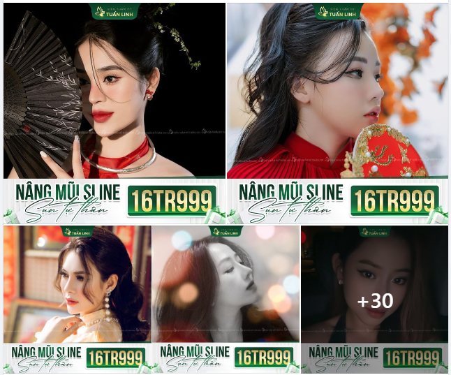 Sở hữu mũi Sline bọc sụn tự thân chỉ 16tr999