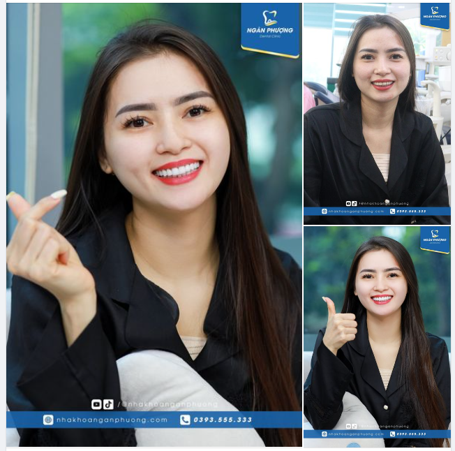 Vẫn trang phục ấy, vẫn gương mặt ấy nhưng răng sứ toàn phần cao cấp đã giúp nụ cười của chị Văn Lý thăng hoa x1000 lần