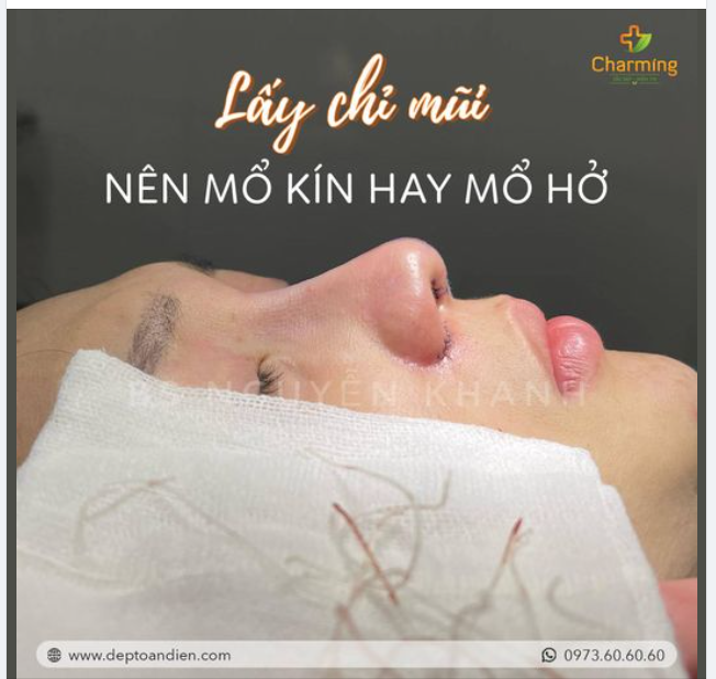 "TẠI SAO CẦN PHẢI MỔ HỞ ĐỂ RÚT CHỈ TRONG MŨI?