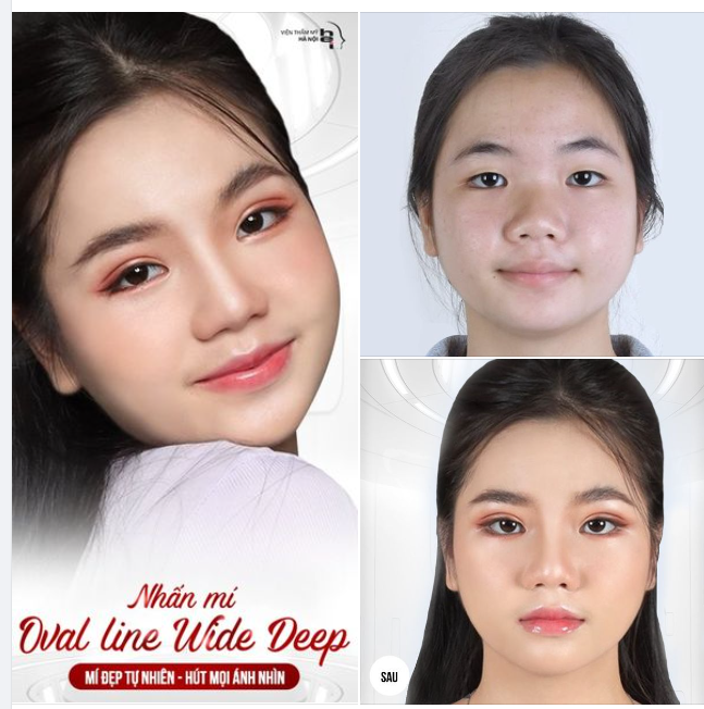 MÍ ĐẸP TỰ NHIÊN - HÚT MỌI ÁNH NHÌN Nhấn mí OVAL LINE WIDE DEEP