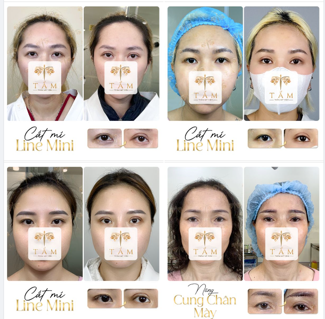 Hình ảnh chân thực của khách hàng sử dụng dịch vụ tại TMV Tấm