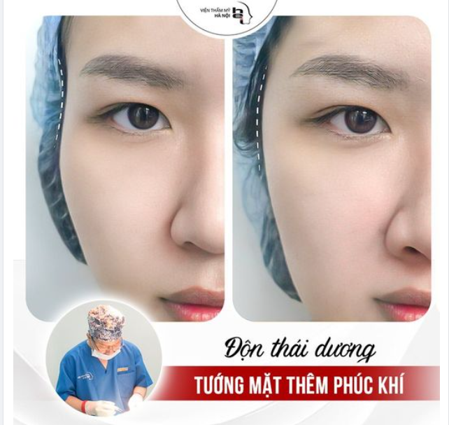 ĐỘN THÁI DƯƠNG - TƯỚNG MẶT TĂNG PHÚC KHÍ