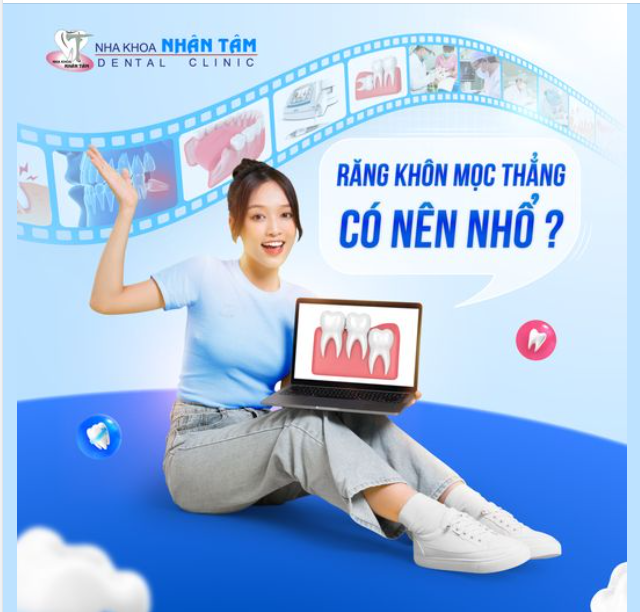 Răng Khôn Mọc Thẳng Có Nên Nhổ?