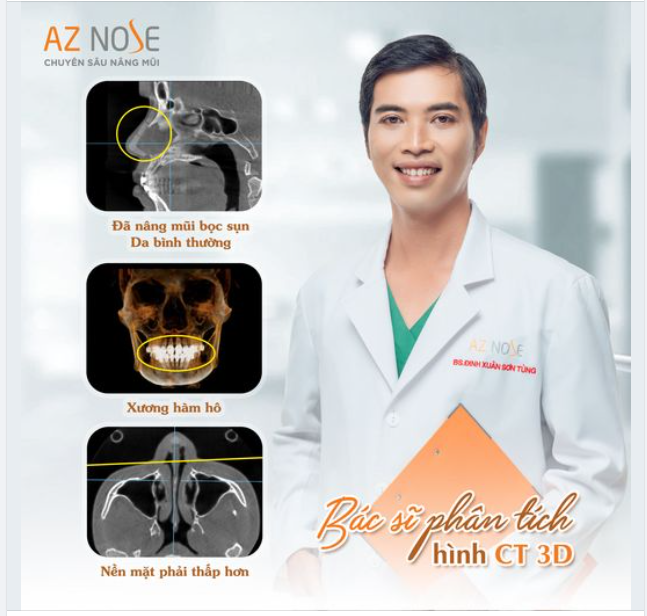 Thấy được gì qua hình CT 3D của trường hợp hô hàm?