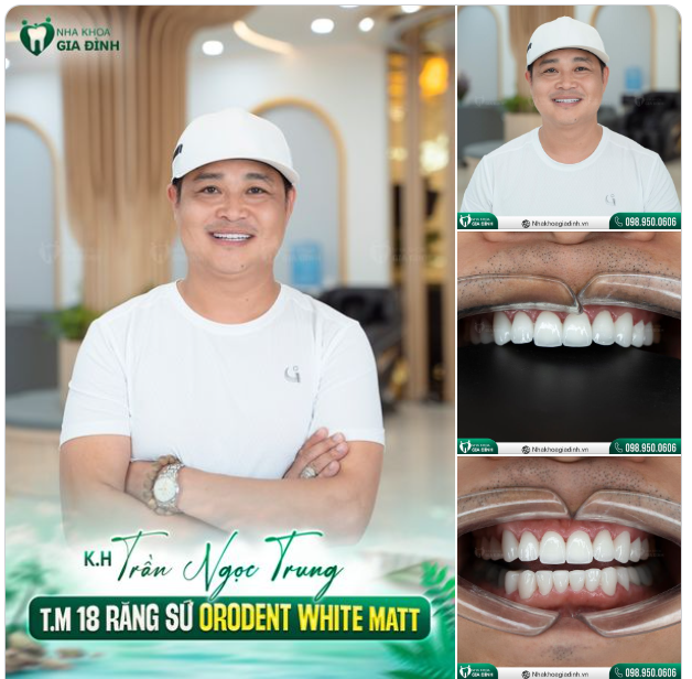 "NẾU ĐƯỢC LỰA CHỌN MỘT LẦN NỮA, ANH VẪN CHỌN LÀM RĂNG TẠI NHA KHOA GIA ĐÌNH"
