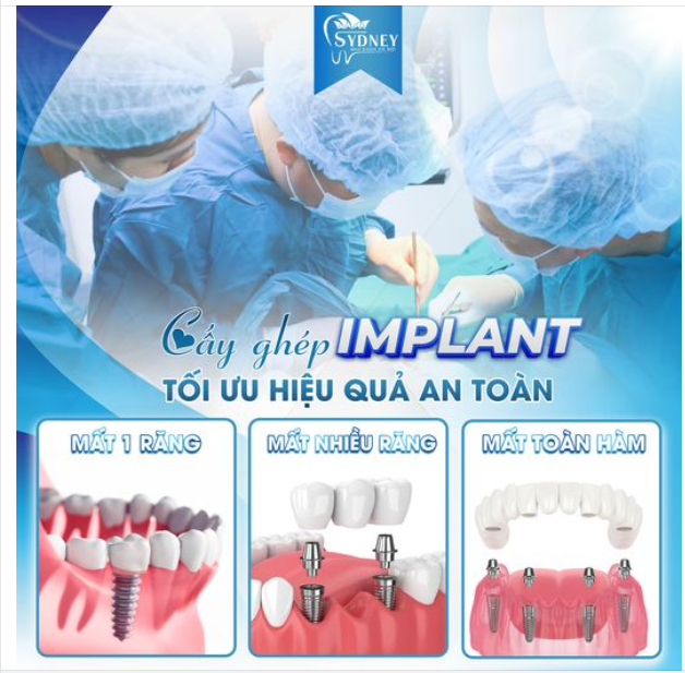 TRỒNG IMPLANT - TỐI ƯU HIỆU QUẢ AN TOÀN