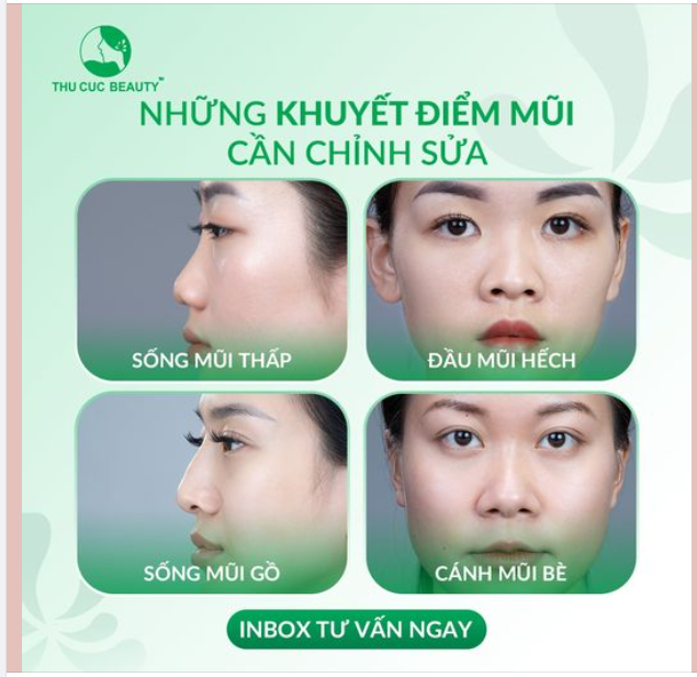 Những khuyết điểm mũi nào cần chỉnh sửa gấp