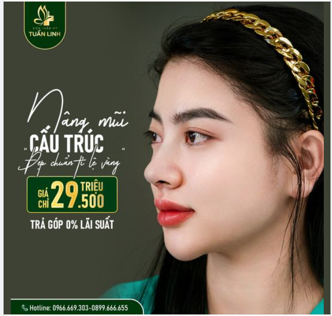 VỚI 29TR500 - NÂNG MŨI CẤU TRÚC - SỞ HỮU NGAY DÁNG MŨI ĐẸP CHUẨN TỶ LỆ VÀNG!!