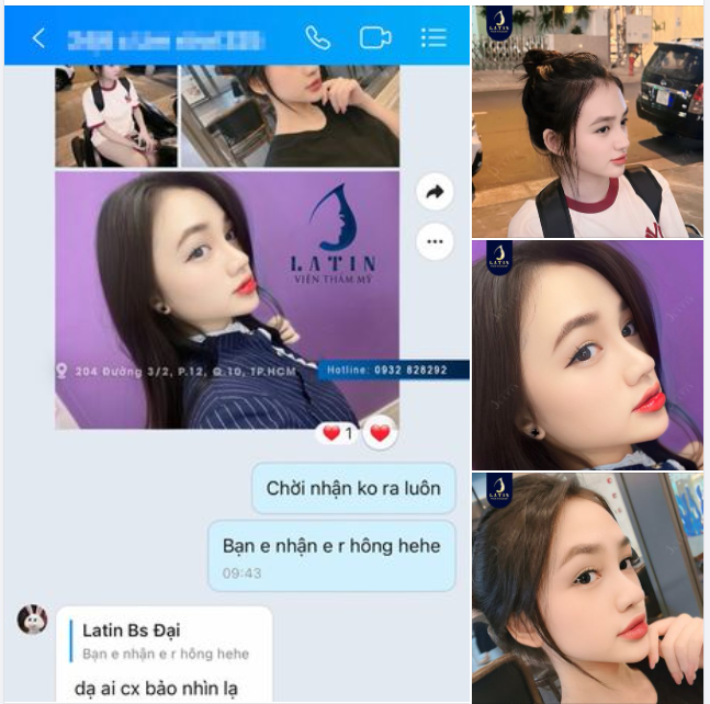 Dù ở tận Nha Trang, nhưng quá thích dáng mũi Latin làm nên em gái quyết tâm vào Sài Gòn làm đẹp