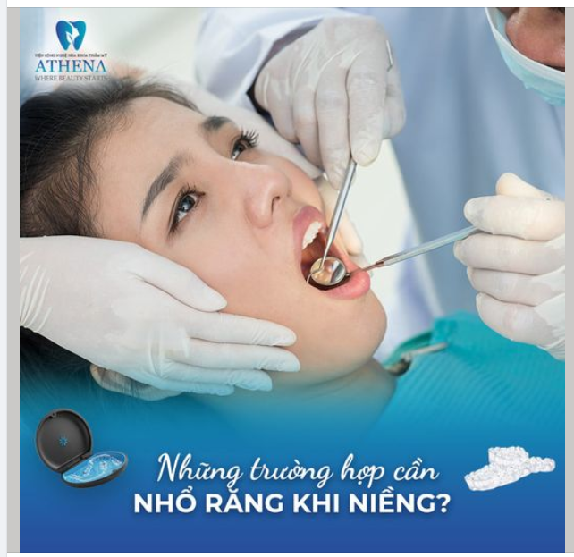 Niềng răng nhanh chóng và hiệu quả với mắc cài tự động