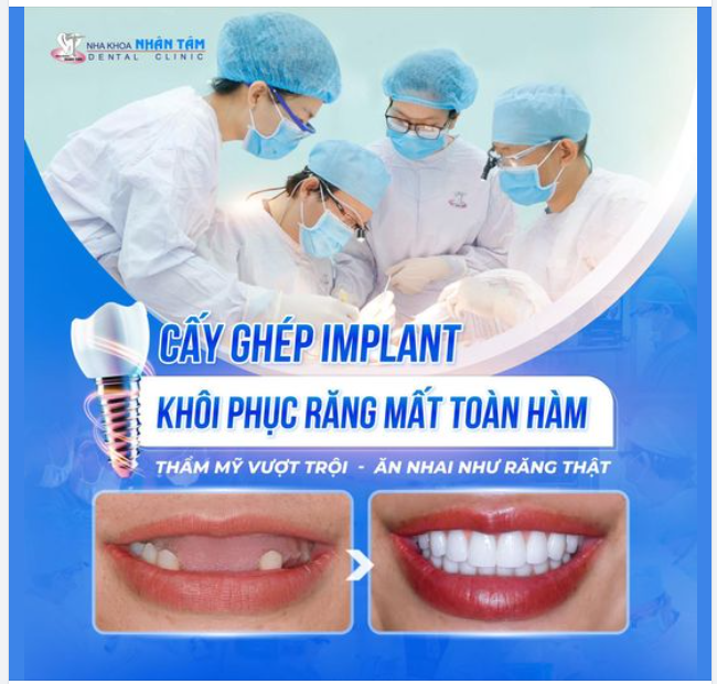 Khách hàng 77 tuổi tìm lại niềm vui trong cuộc sống nhờ cấy ghép Implant