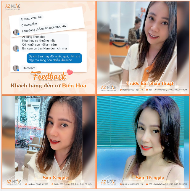 Dáng mũi vừa xinh là tranh thủ feedback