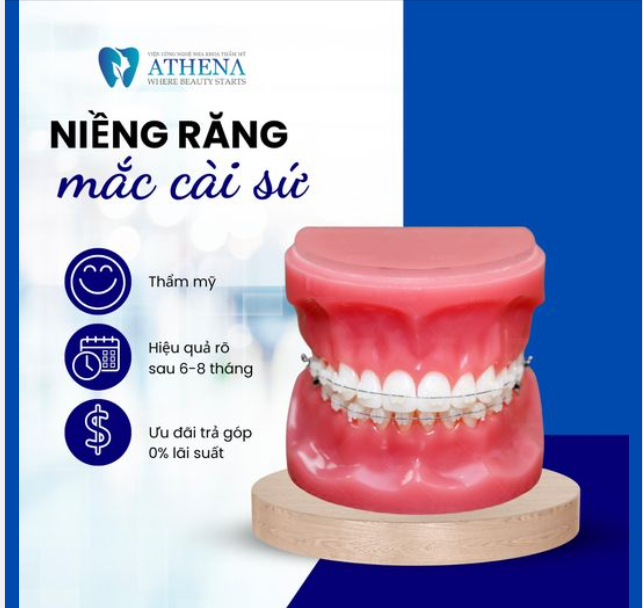 Niềng răng mắc cài sứ không chỉ là một phương pháp điều trị nha khoa hiệu quả mà còn là bí quyết tạo nên nụ cười lấp lánh và tự tin.