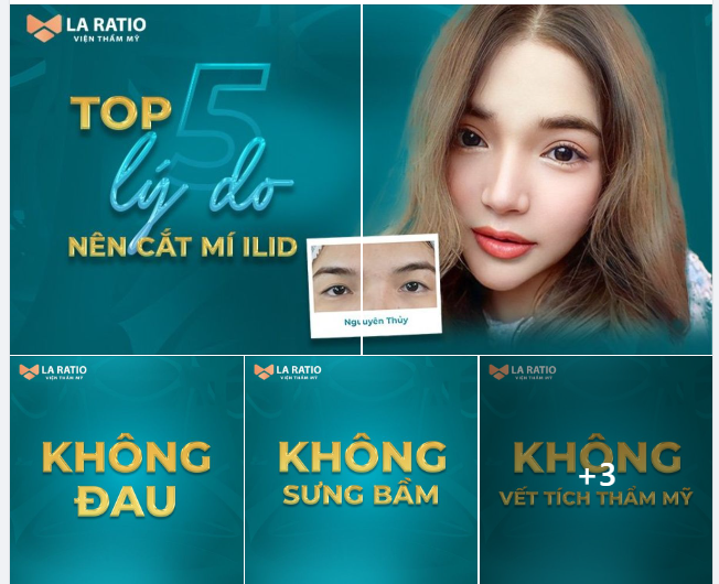 TOP 5 LÝ DO CẮT MÍ ILID CỦA LA RATIO DẪN ĐẦU THỊ TRƯỜNG