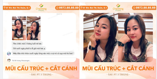 "FLEX CHIẾC MŨI 3 THÁNG TUỔI NÈ BÁC"
