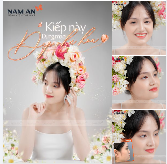 KIẾP NÀY NÂNG MŨI DUNG MẠO ĐẸP NHƯ HOA