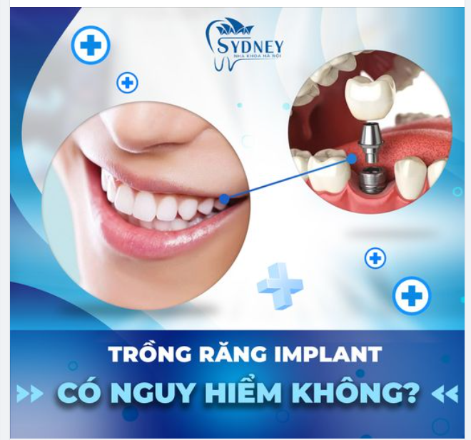 TRỒNG RĂNG IMPLANT CÓ NGUY HIỂM KHÔNG?