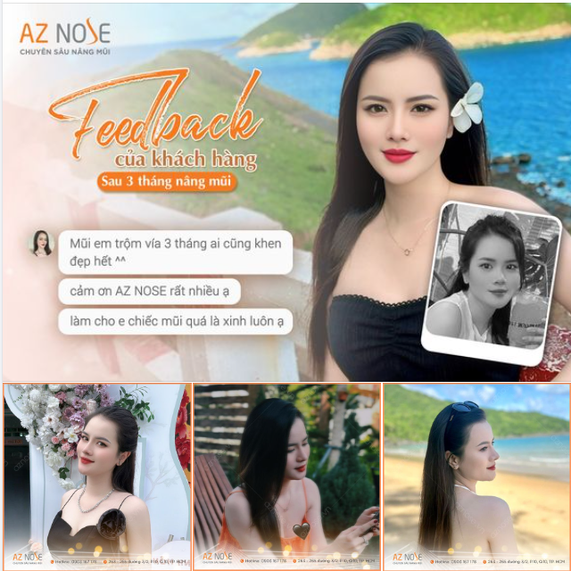 Khuôn mặt sắc nét với dáng mũi 3 tháng tuổi